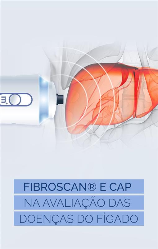 FibroScan e CAP na avaliação das doenças do fígado